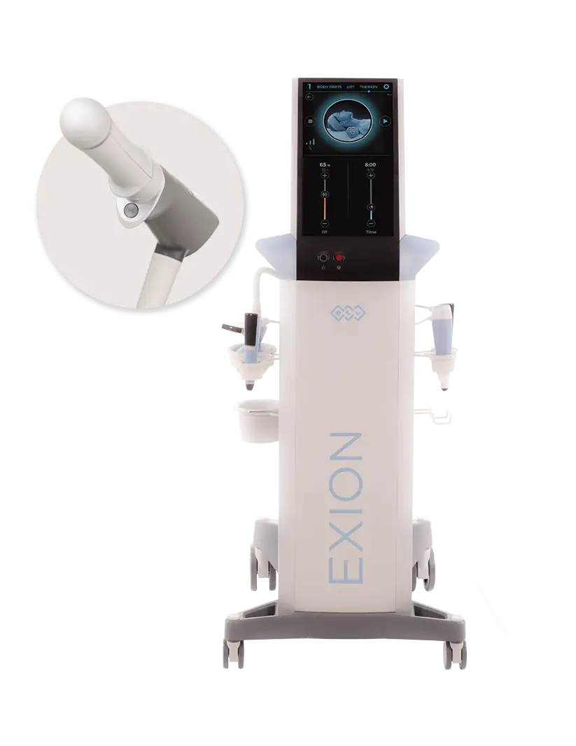 Exion Emfemme